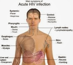 Obat Untuk Penyakit Hiv Aids Obat Untuk Penyakit Hiv Aids