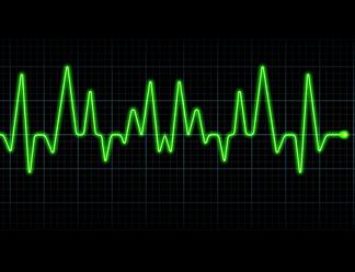 Idioma Ruso-Sucre -  14 Electrocardiograma