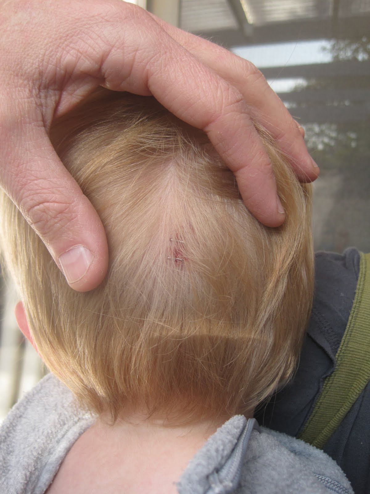 Shannon & Andrew's Blog Staples