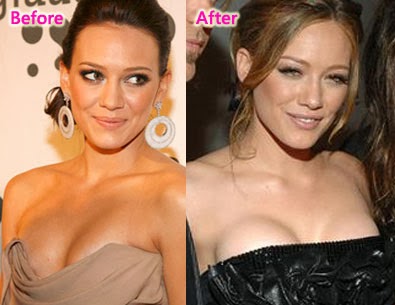 Boobs hilary duff Actresses &