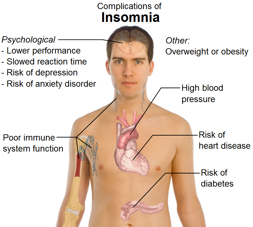 nursing actions for insomnia definition nursing actions for insomnia definition