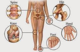 http://neemnet.blogspot.in/2013/12/arthritis-treatments-when-joint.html#more