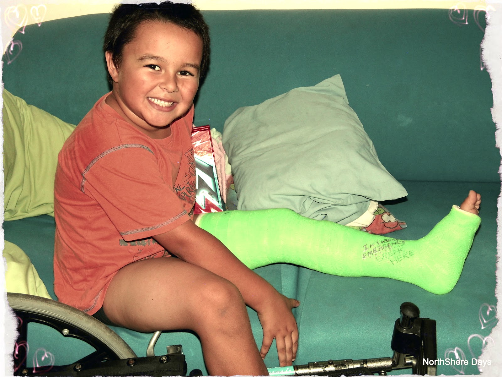 NorthShore Days..... 10 Good Things About A Broken Leg