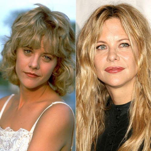 Chatter Busy Meg Ryan Plastic Surgery Before After