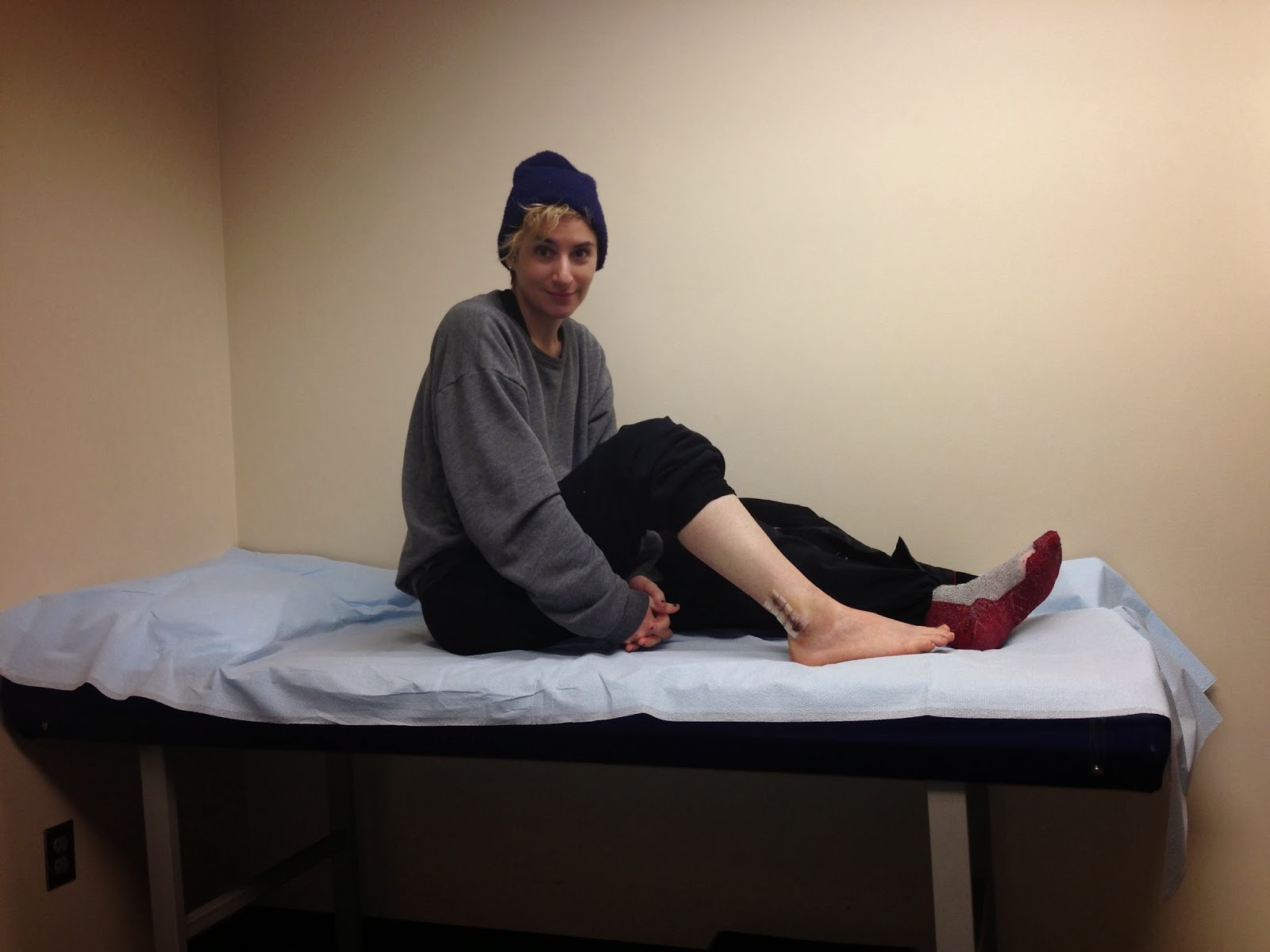 What to Expect When You Break Your Ankle week 1 checkup