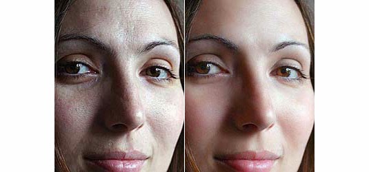 Soften Skin Effect Soften Skin Effect