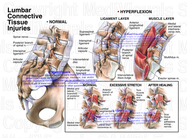 Improve your Health and Wellness 7 Common Cause of Low Back Pain