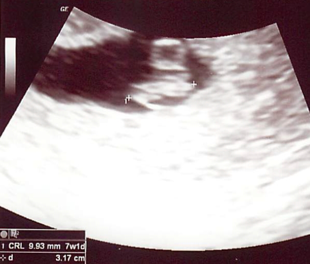 Life and Love in the Petri Dish watch Mo and Will's baby grow!!