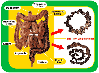 usus banyak toksin