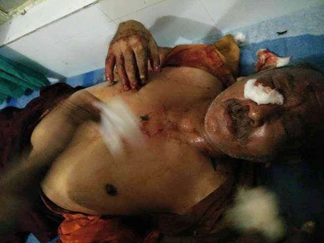 Buddhist monk from Darjeeling, Acharya Chodub Lama, seriously thrashed by Bihar Military Police