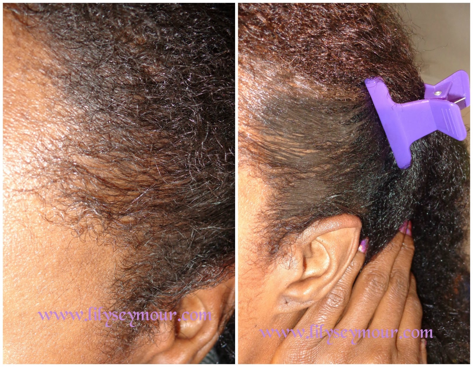 Fun Fierce Fabulous Beauty Over 50! Beauty Thinning