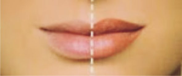 Lippen