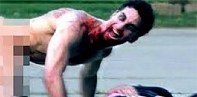 “Σκύλος ” Τοξικομανής επιτέθηκε και δάγκωσε αστυνομικό στου Ψυρρή “Σκύλος ” Τοξικομανής επιτέθηκε και δάγκωσε αστυνομικό στου Ψυρρή