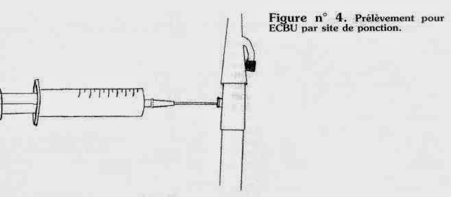 flacon ecbu flacon ecbu