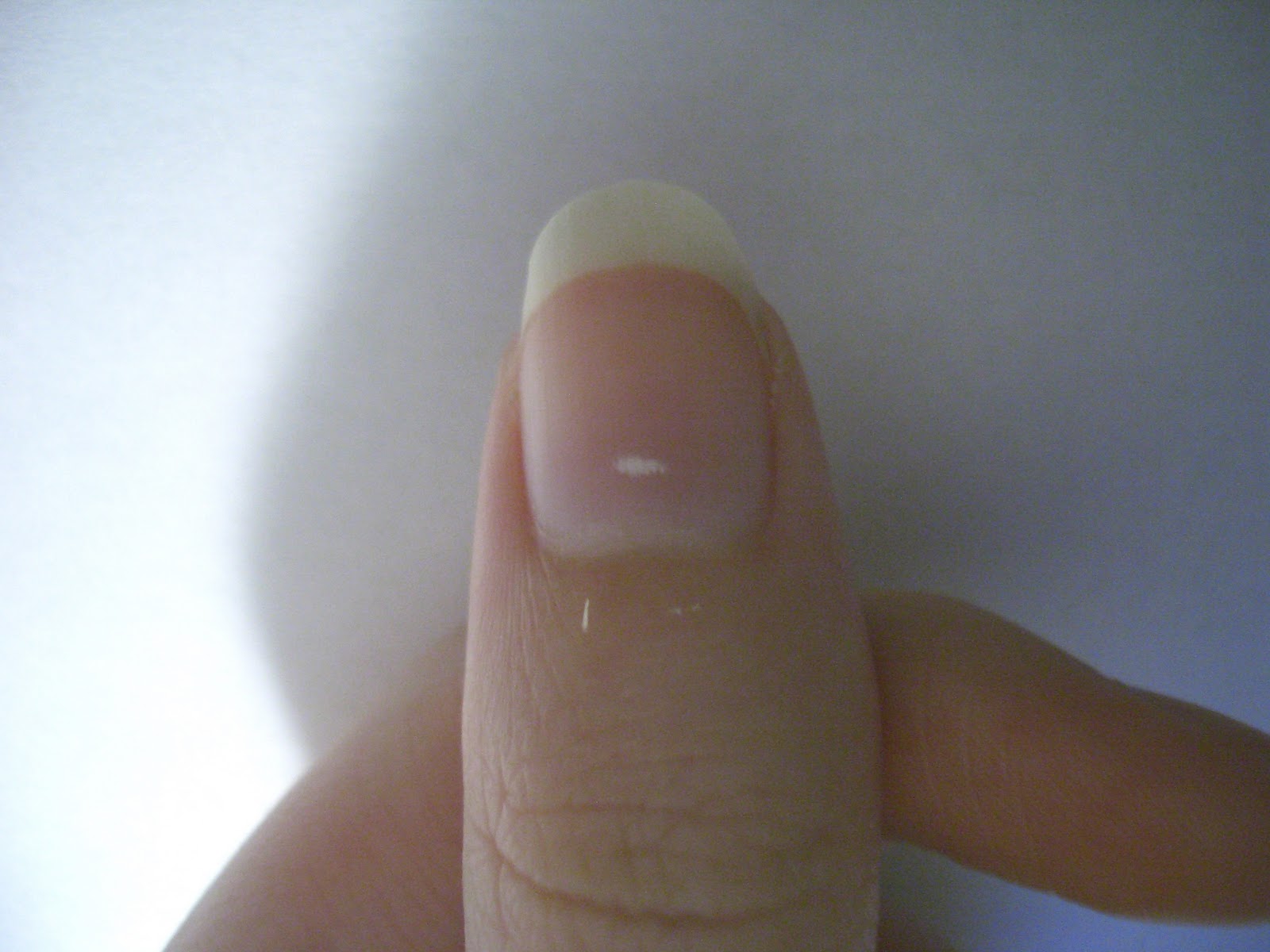 White spots on nails   white fingernails | dr. weil