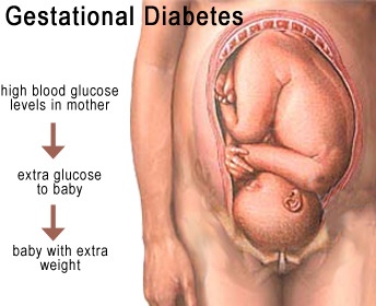 Normal Blood Sugar Levels Chart For Pregnant Women