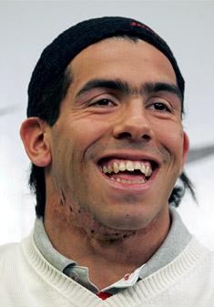 Tevez+face.JPG