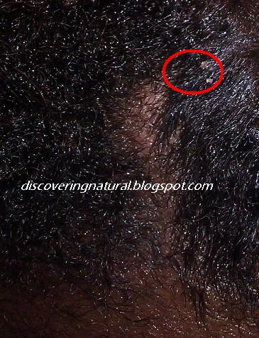 Discoveringnatural Signs Of Product Buildup