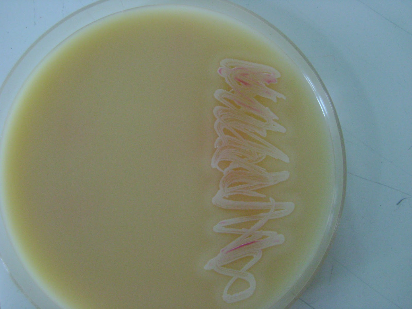 MedicALI Microbiology Oxygen Utilization and the Digestive Enzyme Test