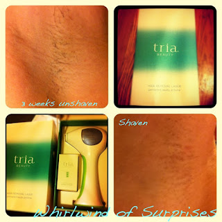 Tria Hair Removal Laser review