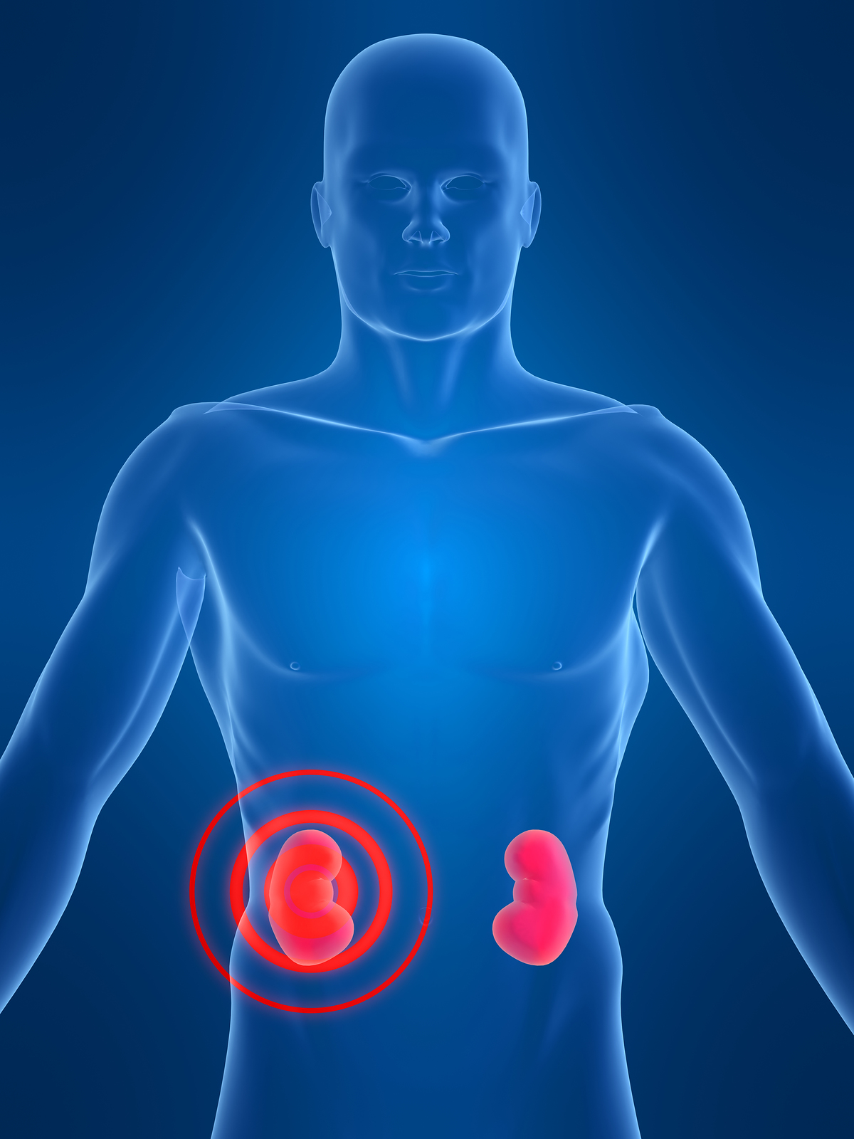 The Healthy Boy Top Fitness Exercise Tips For Kidney Patients