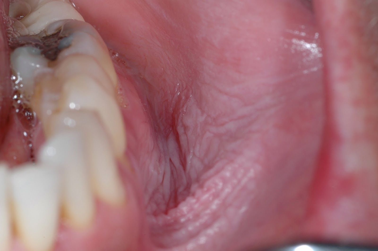 The Buzz from Your Favorite Dental Hygienists August 2013