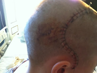 can take percocet before anesthesia