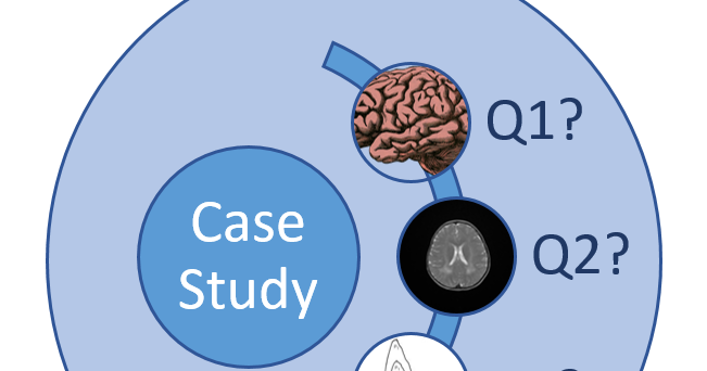 multiple sclerosis case study multiple sclerosis case study