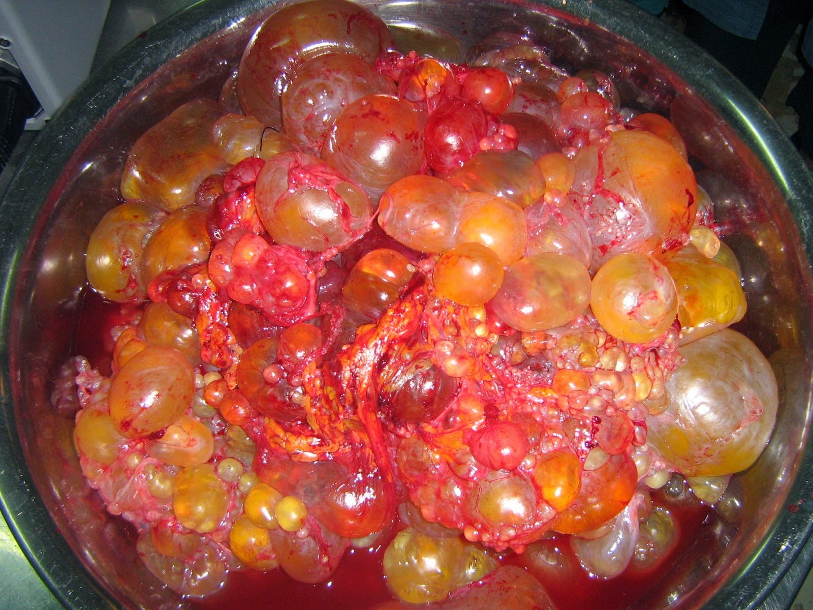 10 Kelainan atau Penyakit pada Sistem Reproduksi ...