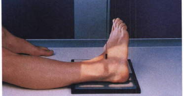Ap Mortise Projection 15 To 20 Degree Medial Rotation Ankle Radtechonduty