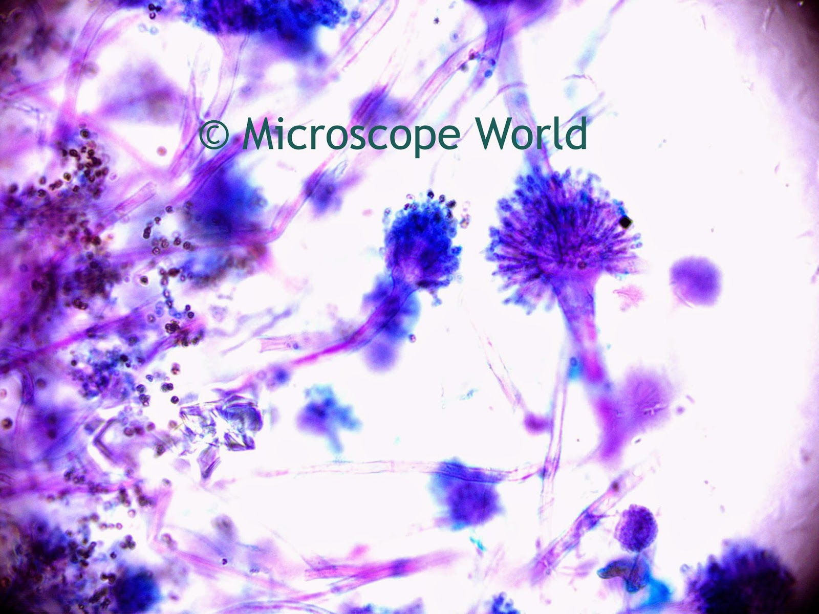 400x image of Aspergillus (mold) under microscope