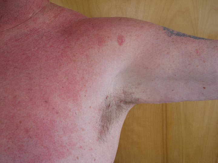 VIRTUAL GRAND ROUNDS IN DERMATOLOGY 2.0