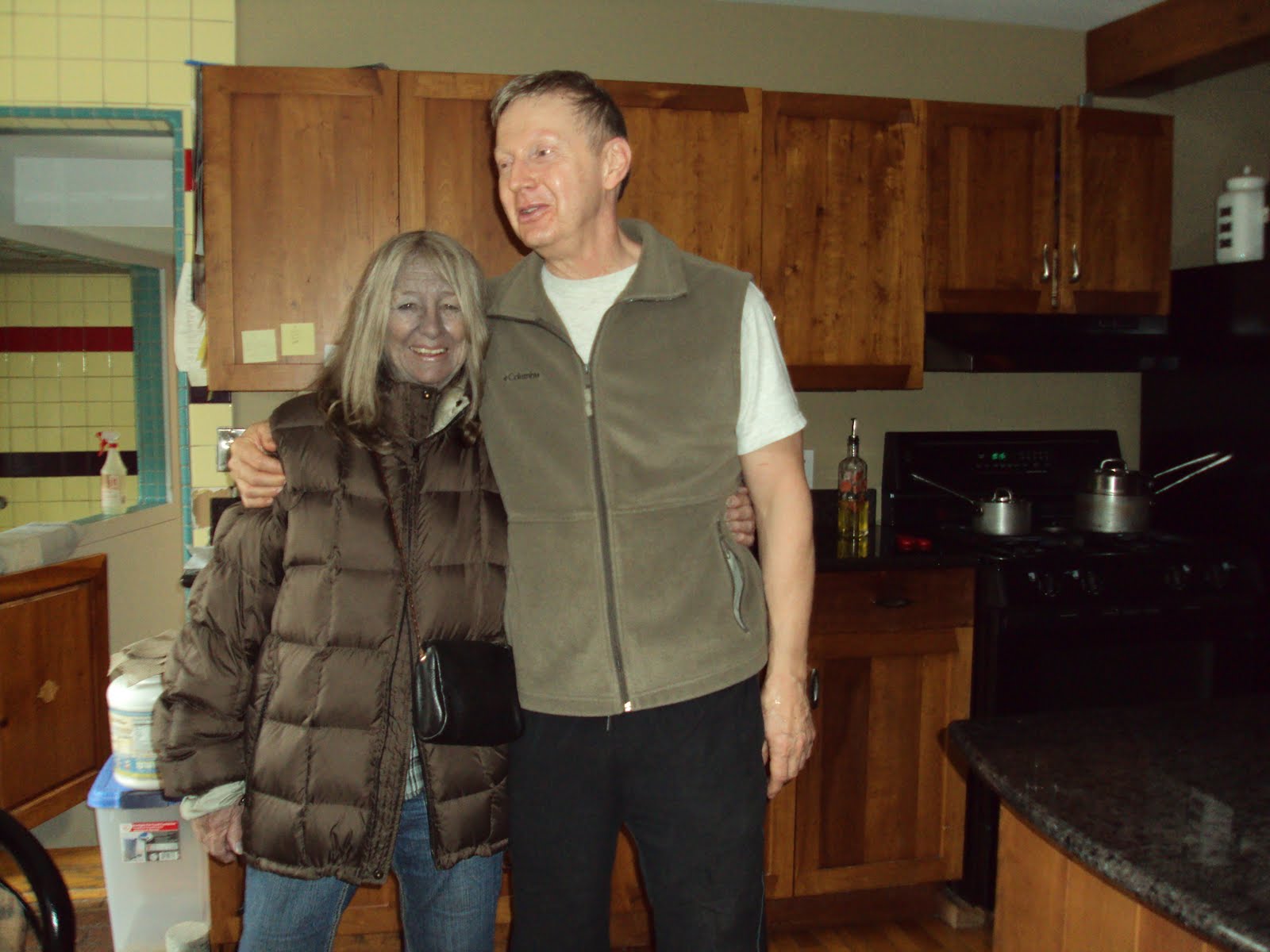 Rosemary's Medical Blog What Argyria Looks Like