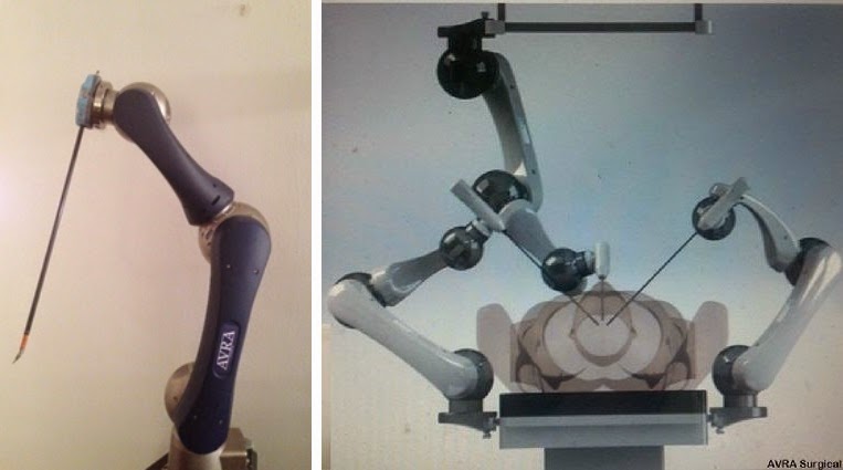 avra surgical robotics