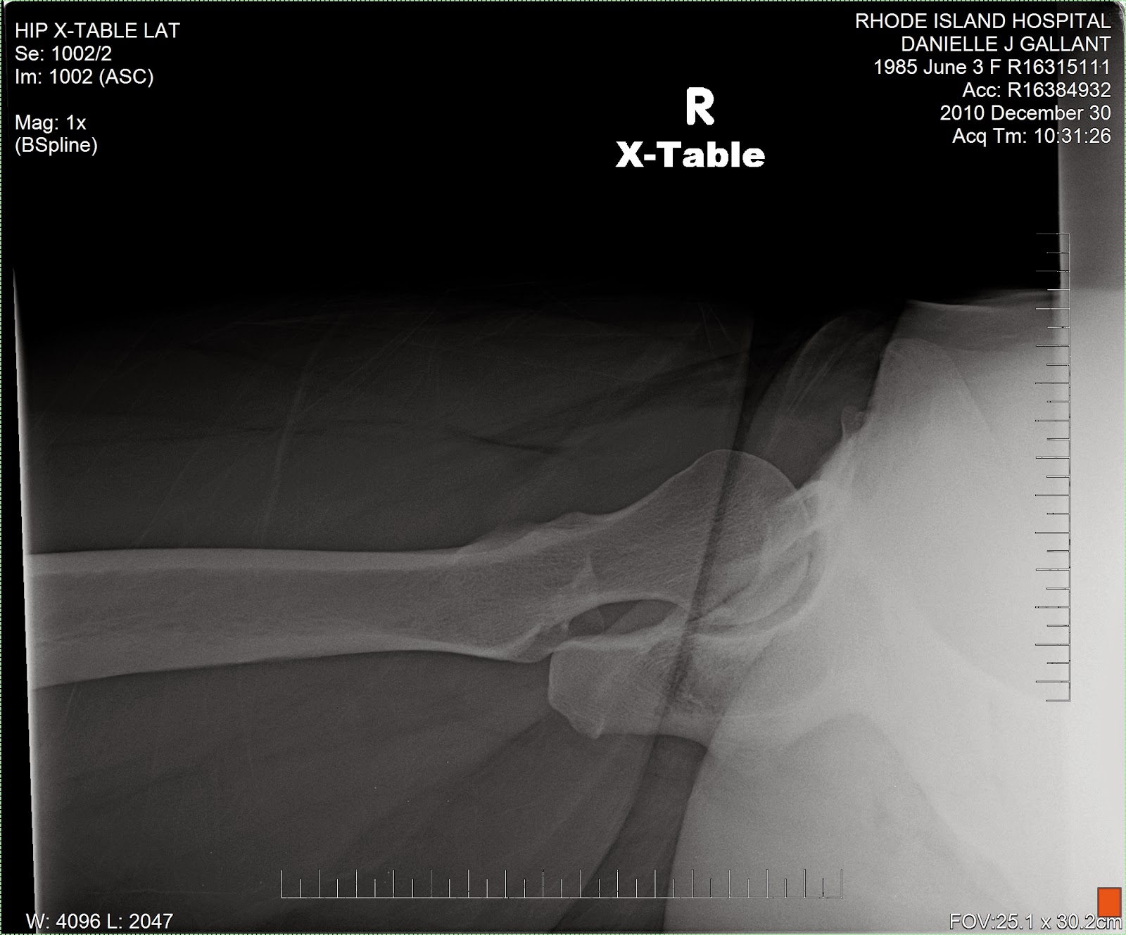 Hipy Chick Living a PAO'd Life October 2013