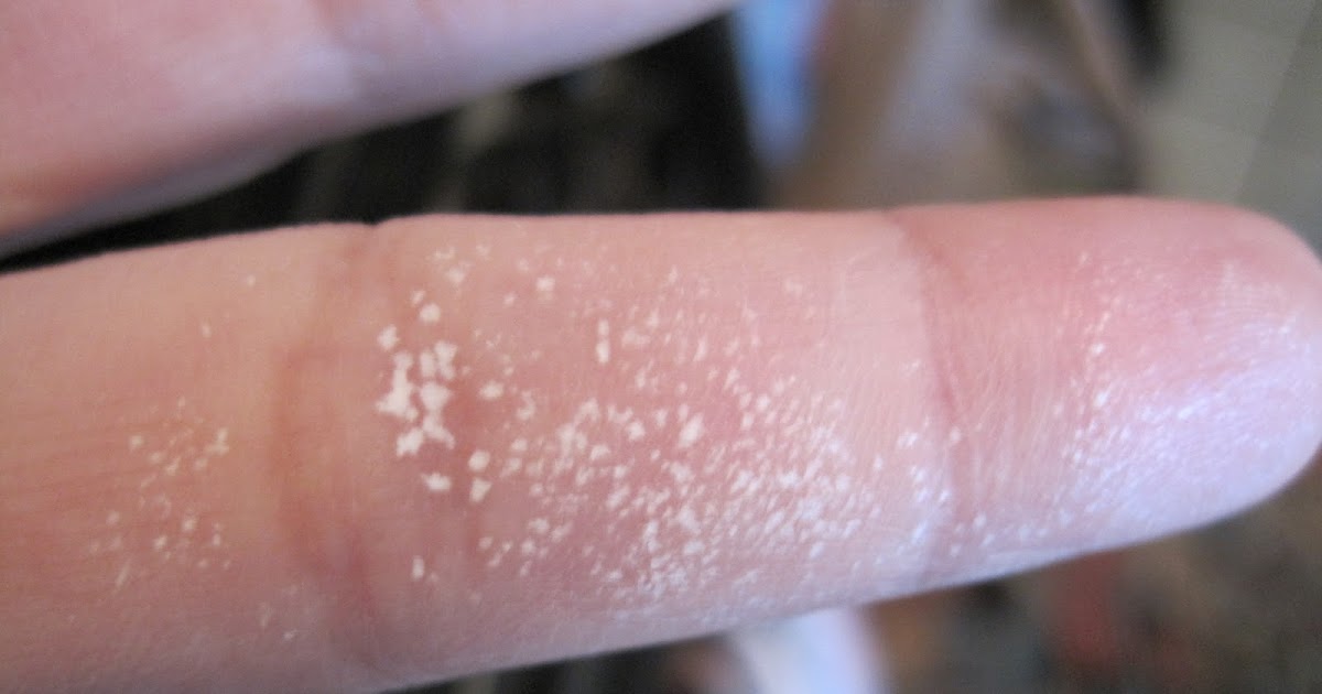 Becca's Backyard Hydrogen Peroxide Can Burn You!!!!