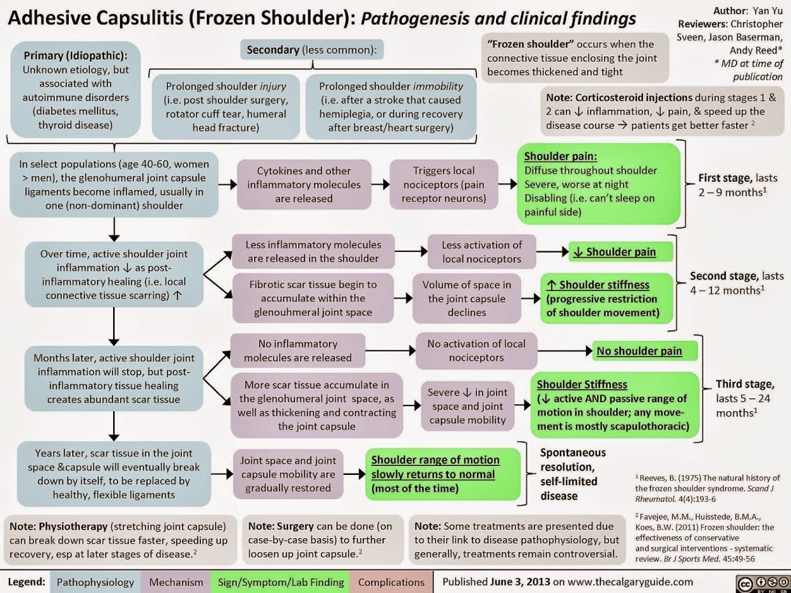 AdhesiveCapsulitisChart.jpg 1,139×854 pixels Frozen shoulder