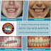 ΤΩΡΑ ΚΑΙ ΣΤΗΝ ΕΛΛΑΔΑ: Ίσια δόντια, χωρίς εξαγωγές δοντιών με την χρήση επαναστατικής ορθοδοντικής τεχνολογίας 