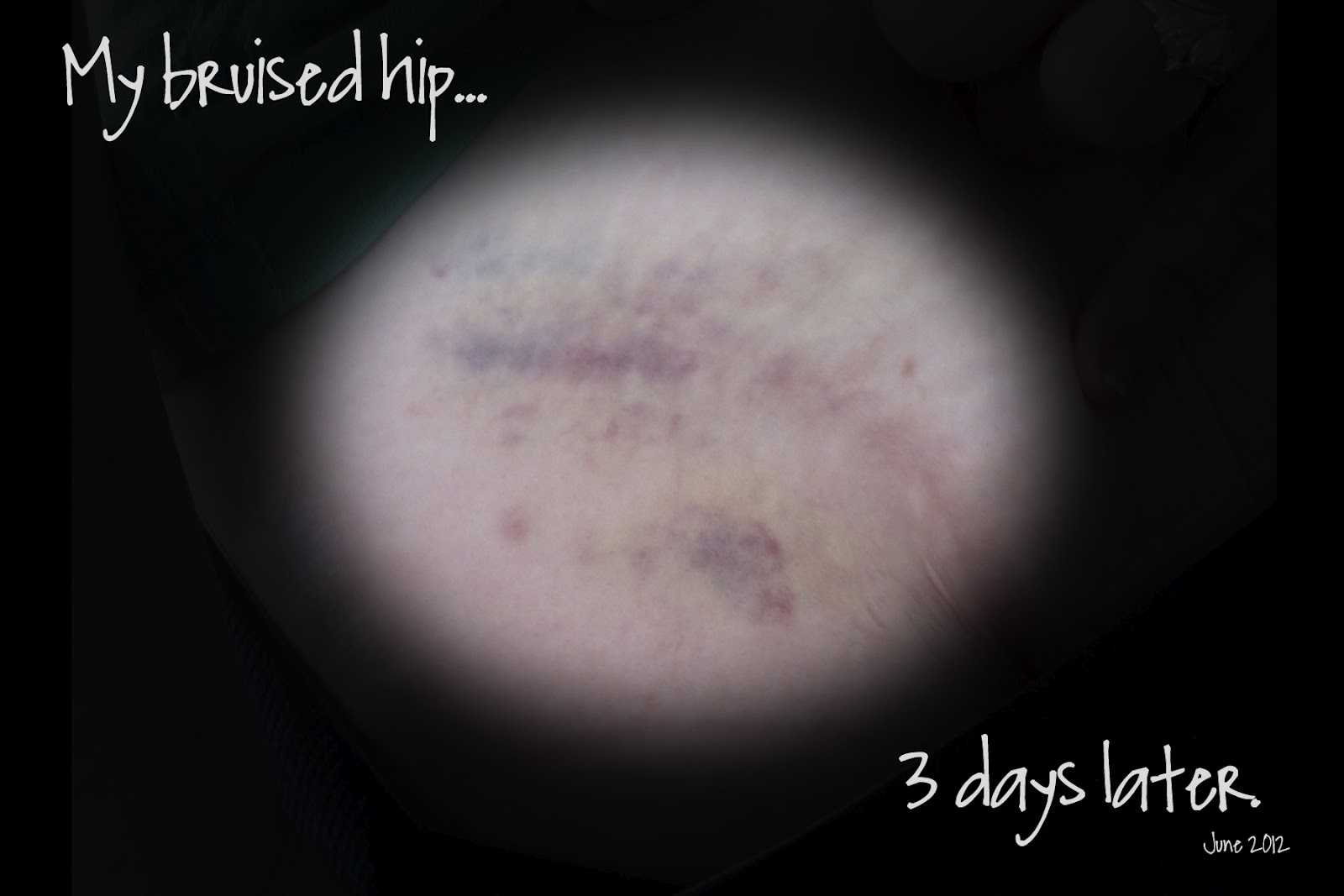 Hip flexor pain referral jobs, how to build hip flexor muscles massage