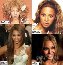Beyonce plastic surgery - the Truth
