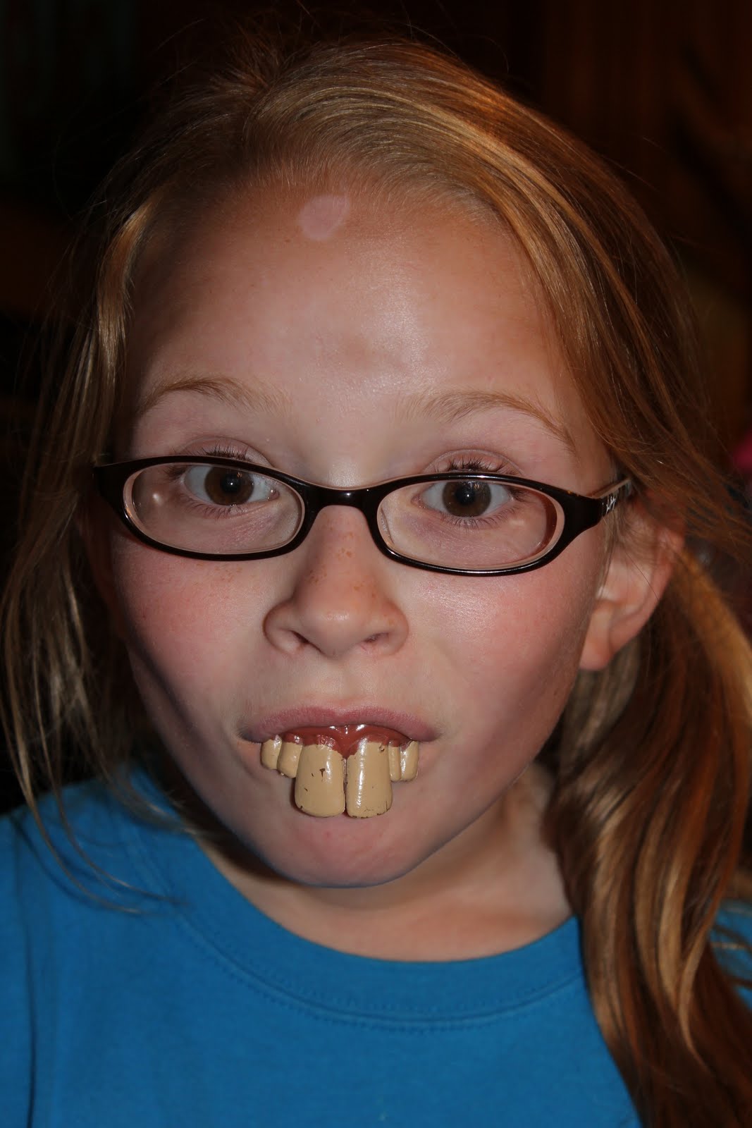 Fake Hillbilly Teeth