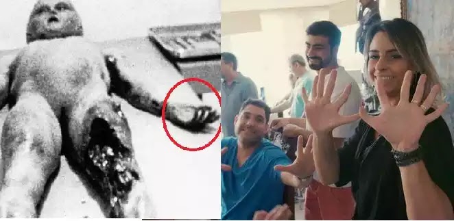 Όταν εκδηλώνονται τα εξωγήινα γονίδια βγαίνουν οι … Εξαδάχτυλοι: Η οικογένεια με τα 14 μέλη και τη σπάνια γεννητική ανωμαλία ! Όταν εκδηλώνονται τα εξωγήινα γονίδια βγαίνουν οι … Εξαδάχτυλοι: Η οικογένεια με τα 14 μέλη και τη σπάνια γεννητική ανωμαλία !