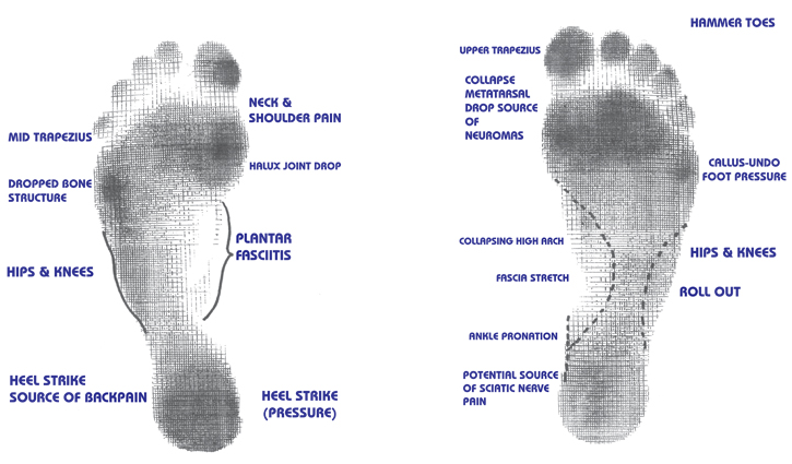 Podiatry- Importance of Footcare in Diabetics: Common foot problems