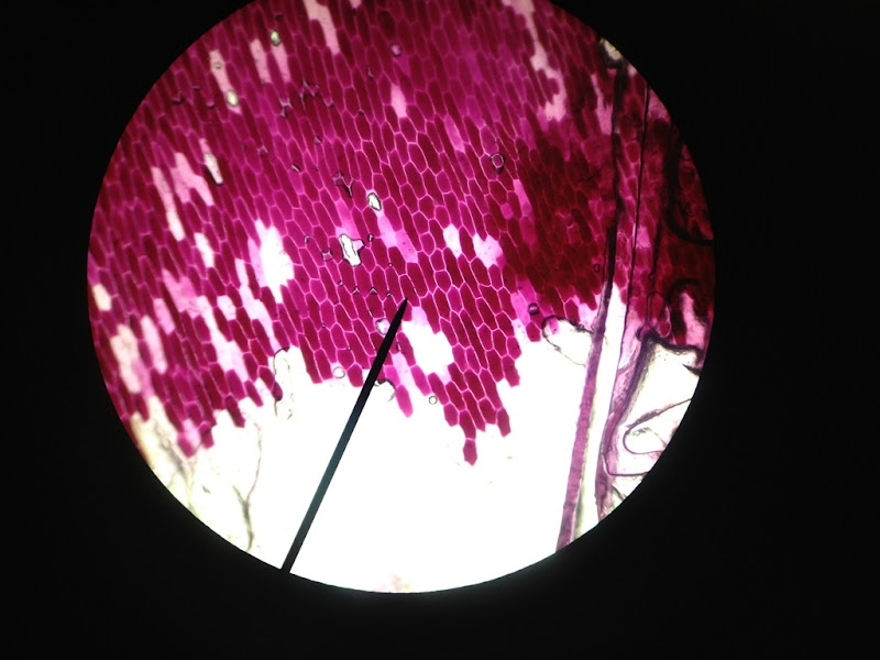 red onion cell lab essay The mcgill physiology virtual lab blood red cell fragility osmotic hemolysis : cell membranes are semipermeable barriers, (hemolysis) which dissolves in. red onion cell lab essay The mcgill physiology virtual lab blood red cell fragility osmotic hemolysis : cell membranes are semipermeable barriers, (hemolysis) which dissolves in.