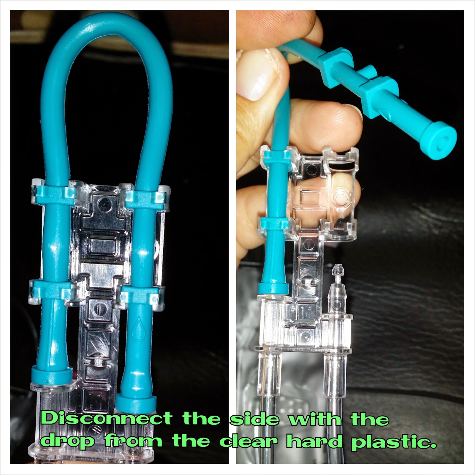 Spastic Quadriplegic Cerebral Palsy How To Convert Zevex Infinity Very Clever For Anyone That Needs To Gravity Feed In A Pinch When Pump Had No Way Charge Or Breaks