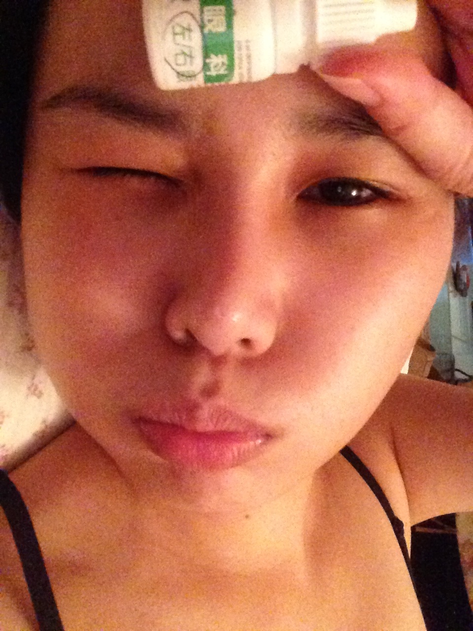 Jovie S Diary 準分子近視雷射