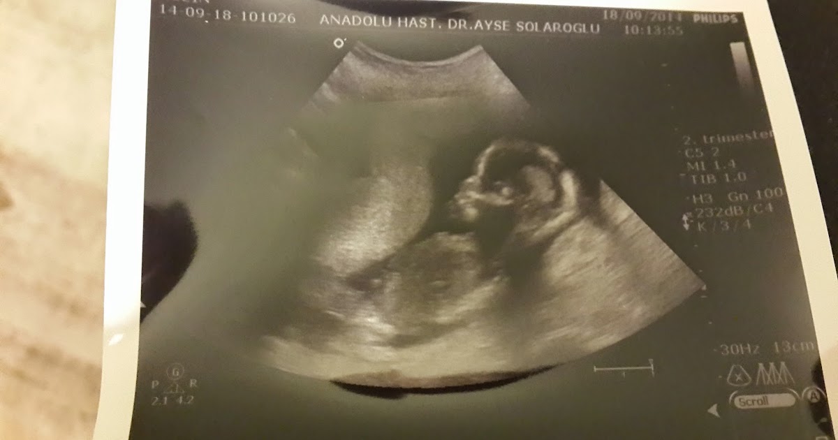 İçimde büyüyen minik eller , minik ayaklar ve minicik bir