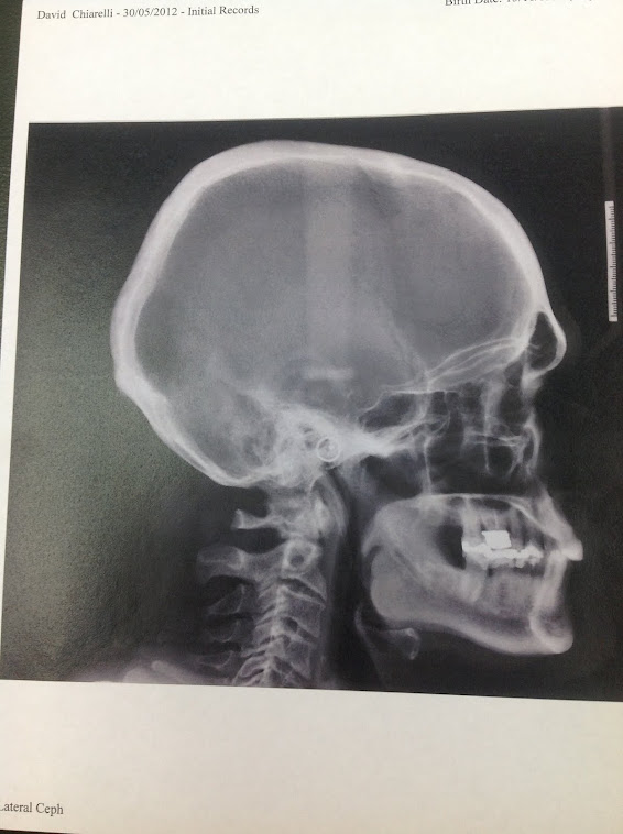 This is my skull + my brain.