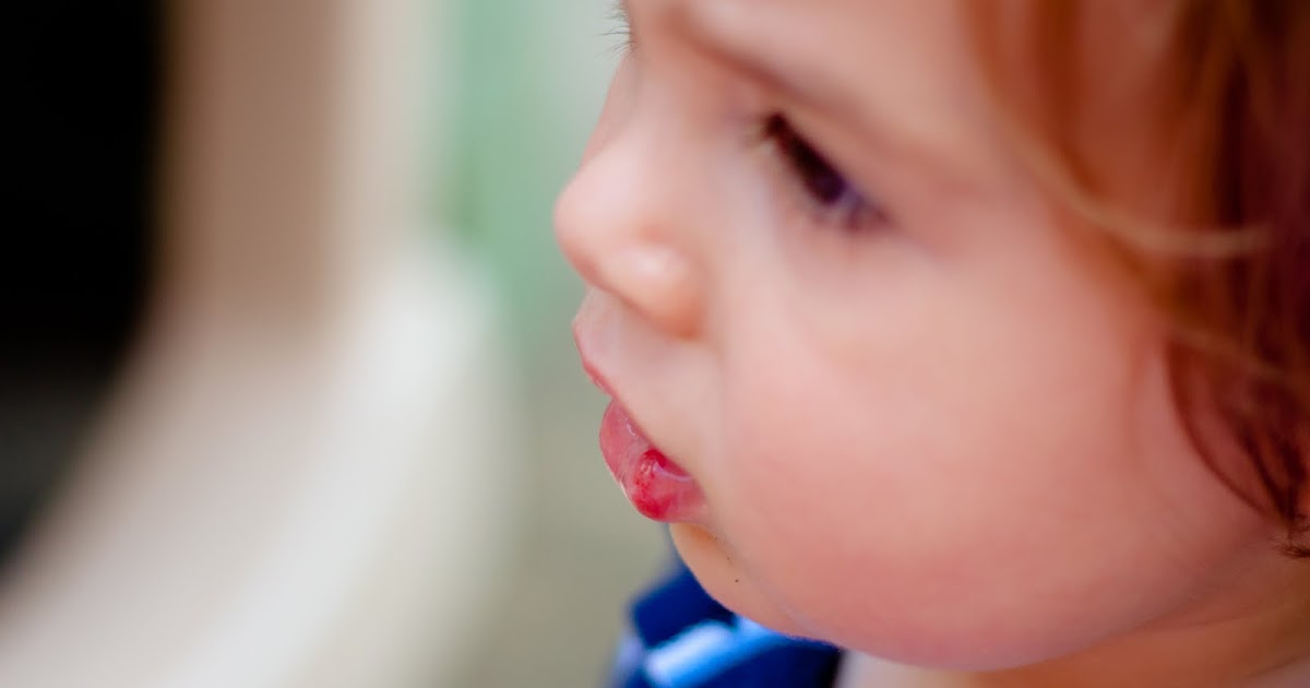 The Edwards Busted Lip