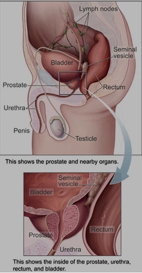 Dr Md Fazlul Hoque What Is Prostate Cancer Causes And Protect System